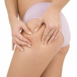 Beauty Q&A: What Causes Cellulite, and How Can You Get Rid of it?