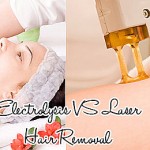 Laser Vs Electrolysis Hair Removal